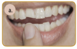 dientes